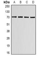 Lamin B Receptor Rabbit Polyclonal Antibody