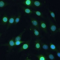 Lamin B Receptor Rabbit Polyclonal Antibody