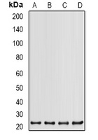 PSMB2 Rabbit Polyclonal Antibody