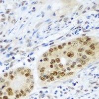 PSMB2 Rabbit Polyclonal Antibody