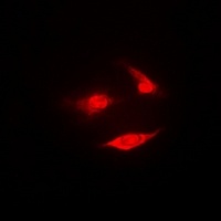 PSMB2 Rabbit Polyclonal Antibody