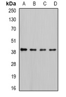 RFC4 Rabbit Polyclonal Antibody