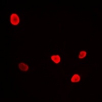 RFC4 Rabbit Polyclonal Antibody