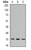 UBE2C Antibody