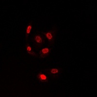 TLE1 Rabbit Polyclonal Antibody