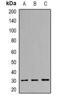 PNMTase Rabbit Polyclonal Antibody