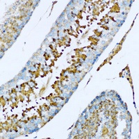 Hemopexin Rabbit Polyclonal Antibody
