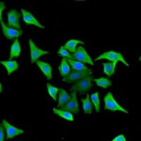 Hemopexin Rabbit Polyclonal Antibody