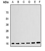 GABARAP Rabbit Polyclonal Antibody