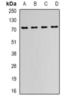 FMR1 Rabbit Polyclonal Antibody