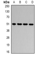HADHB Rabbit Polyclonal Antibody