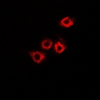 HADHB Rabbit Polyclonal Antibody