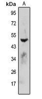 FDPS Rabbit Polyclonal Antibody