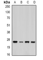 PSMA5 Rabbit Polyclonal Antibody