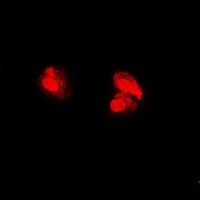 PSMA5 Rabbit Polyclonal Antibody