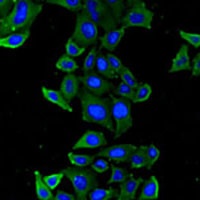 Thrombospondin-5 Rabbit Polyclonal Antibody