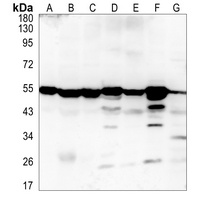 PRMT2 Rabbit Polyclonal Antibody