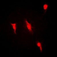 PRMT2 Rabbit Polyclonal Antibody