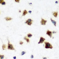 HuC Rabbit Polyclonal Antibody