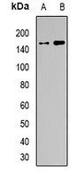 BAF155 Rabbit Polyclonal Antibody