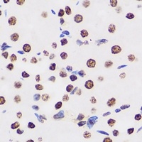 BAF155 Rabbit Polyclonal Antibody