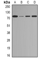 BORIS Rabbit Polyclonal Antibody