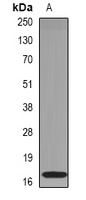 RNase 1 Rabbit Polyclonal Antibody