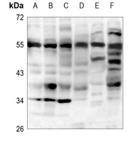 IRAK4 Rabbit Polyclonal Antibody