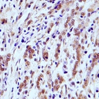 IRAK4 Rabbit Polyclonal Antibody