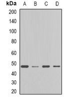 FDFT1 Rabbit Polyclonal Antibody