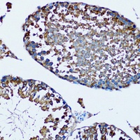 FDFT1 Rabbit Polyclonal Antibody