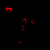 FDFT1 Rabbit Polyclonal Antibody