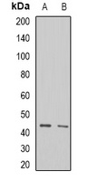 ALKB Rabbit Polyclonal Antibody