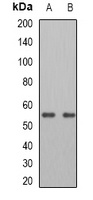 ATGL Rabbit Polyclonal Antibody