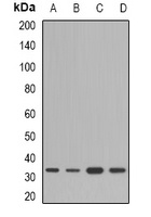 HSD17B13 Rabbit Polyclonal Antibody