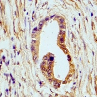 HSD17B13 Rabbit Polyclonal Antibody