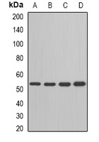 ADSL Rabbit Polyclonal Antibody