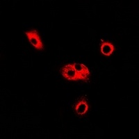 ADSL Rabbit Polyclonal Antibody