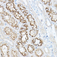 Neu1 Rabbit Polyclonal Antibody