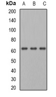 PGM1 Rabbit Polyclonal Antibody