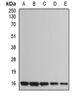UBE2B Antibody
