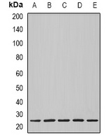 Nop30 Antibody