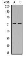 ASL Rabbit Polyclonal Antibody