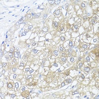 ASL Rabbit Polyclonal Antibody