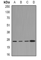CLIC1 Rabbit Polyclonal Antibody