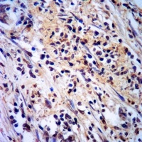 CAT1 Antibody