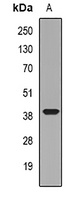 Pinch-1 Rabbit Polyclonal Antibody