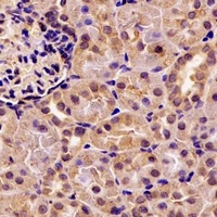 Pancreatic Lipase Rabbit Polyclonal Antibody