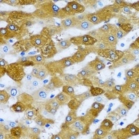 RPL9 Rabbit Polyclonal Antibody