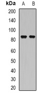 SSRP1 Rabbit Polyclonal Antibody
